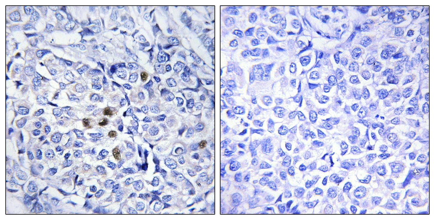 Polyclonal Rabbit anti-Human PLK1 / PLK-1 Antibody (phospho-Thr210, IHC)