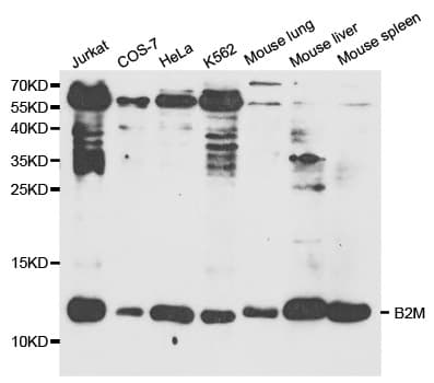 PathPlus™ B2M / Beta 2 Microglobulin Antibody