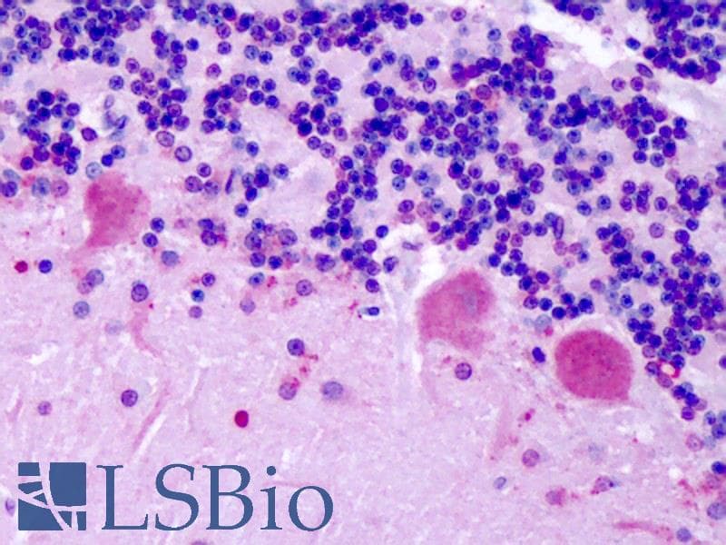 IHC-plus™ CHRM2 / M2 Antibody (Cytoplasmic Domain)
