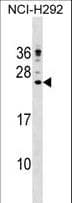 Polyclonal Rabbit anti-Human LL37 / Cathelicidin Antibody (aa123-152, WB)