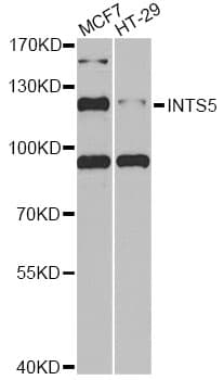 Polyclonal Rabbit anti-Human INTS5 Antibody (IHC, WB)
