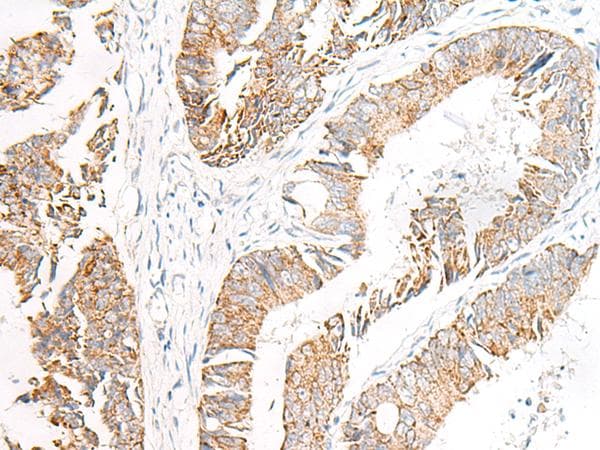 FGR Antibody