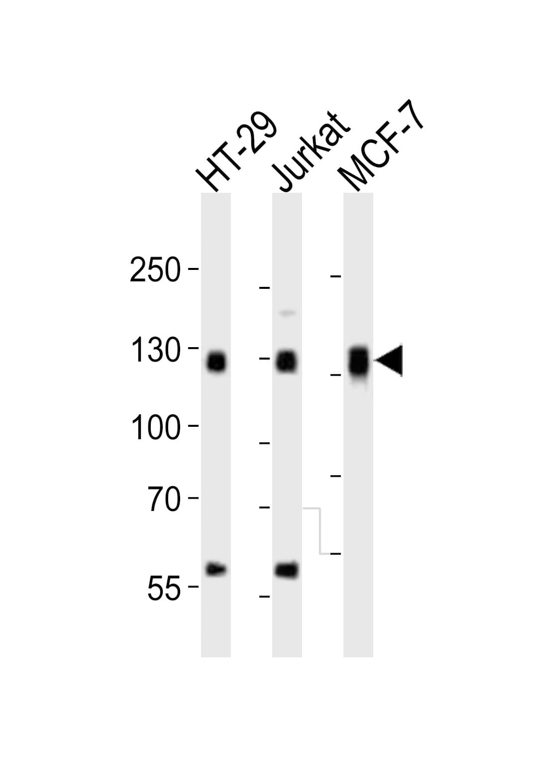 Polyclonal Rabbit anti-Human SMG7 Antibody (aa896-930, WB)