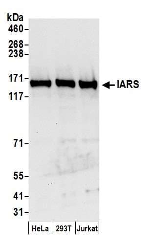 Polyclonal Rabbit anti-Human IRS Antibody (aa1-50, WB)