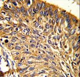 PRDX3 / Peroxiredoxin 3 Antibody (aa66-94)