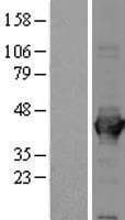 ALDOA / Aldolase A Protein (Over-Expression Lysate Myc-DDK (Flag))
