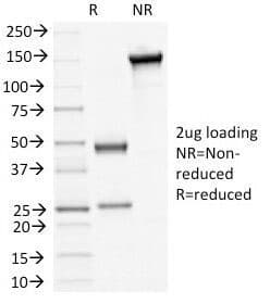 DSG3 / Desmoglein 3 Antibody (clone 5H10)
