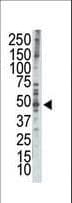 RAD9A / RAD9 Antibody (aa1-30)