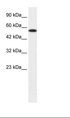 CHEK1 / CHK1 Antibody (aa192-241)