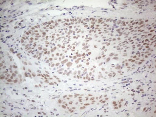 HDAC2 Antibody (aa415-488, clone OTI7E10)