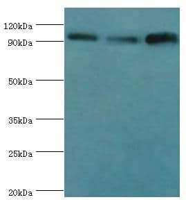 HSPH1 / HSP105 Antibody (aa659-858)