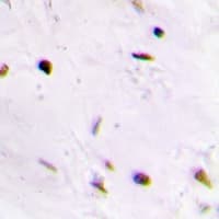 QDPR / DHPR Antibody