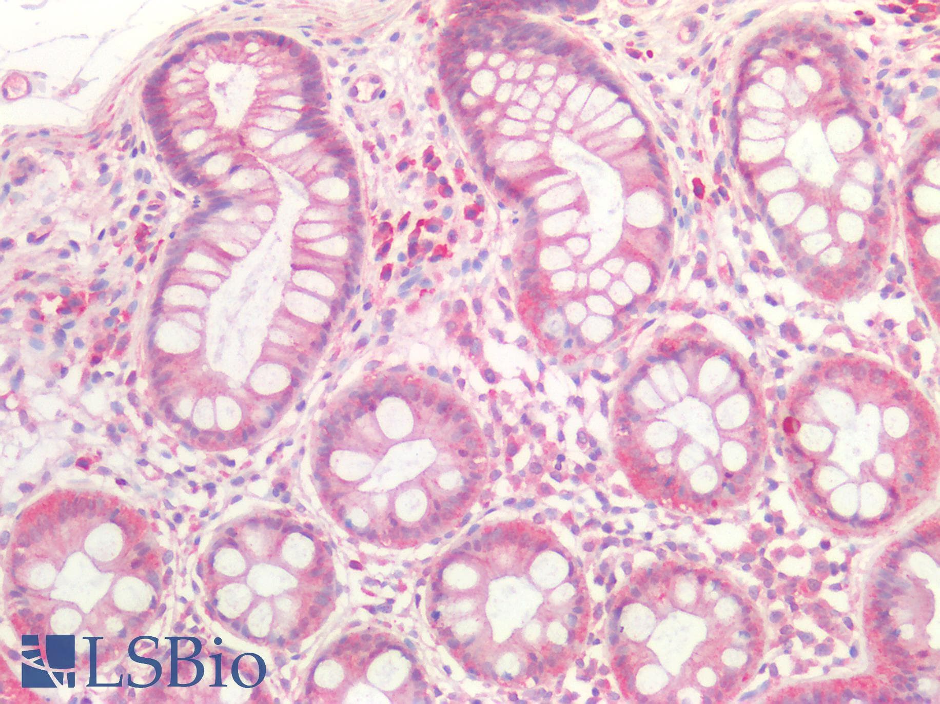 PathPlus™ Polyclonal Rabbit anti-Human GDF15 Antibody (IHC)