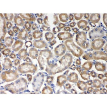 AIM2 Antibody (aa14-215)