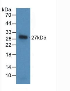 NOG / Noggin Antibody