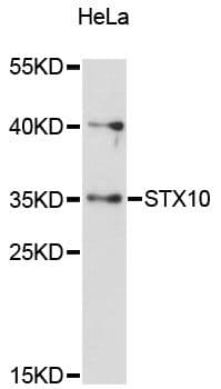 Polyclonal Rabbit anti-Human STX10 / Syntaxin 10 Antibody (WB)