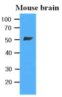 IHC-plus™ Monoclonal Mouse anti-Human TUBB / Beta Tubulin Antibody (clone AT5B2, IHC, IF, WB)