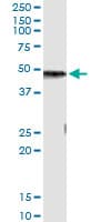 CPB / Carboxypeptidase B Antibody (clone 4D5)
