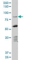 Monoclonal Mouse anti-Human DAZ1 / DAZ Antibody (clone 3E3, IHC, WB)