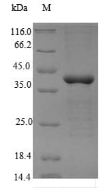 Human PRKAG2 / AMPK Gamma 2 Protein (Recombinant 6His, N-terminus)