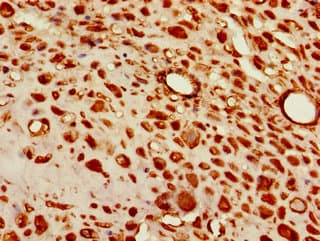 TBX6 Antibody