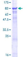 Human CHAF1B / CAF1 Protein (Recombinant GST)