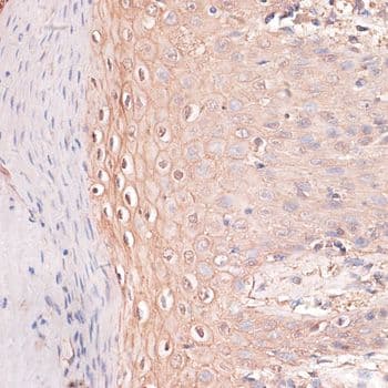 Polyclonal Rabbit anti-Human CDH3 / P-Cadherin Antibody (IHC, WB)