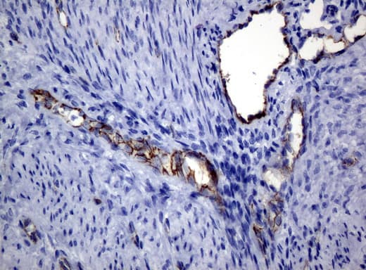 PECAM-1 / CD31 Antibody (clone UMAB30)