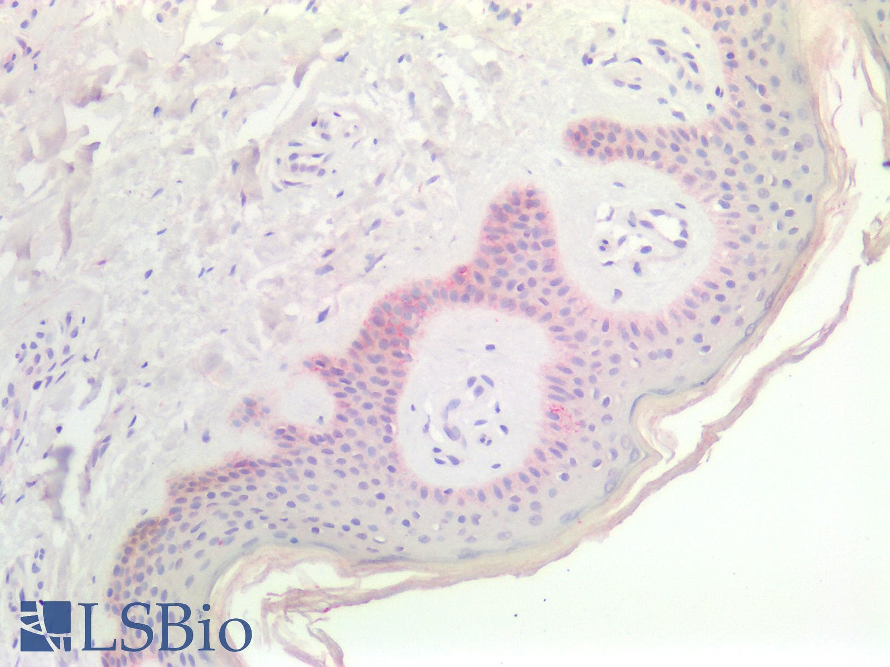 IHC-plus™ CDH3 / P-Cadherin Antibody