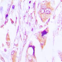 IgG1 Antibody (Internal)
