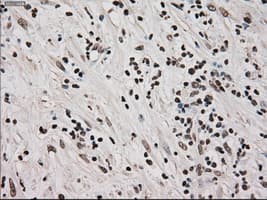 Monoclonal Mouse anti-Human MKI67 / Ki67 Antibody (clone OTI3D11, IHC, WB)