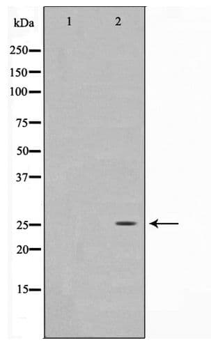 Polyclonal Rabbit anti-Human MOB1B / MOBKL1A Antibody (WB)