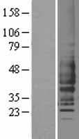 C5AR1 / CD88 / C5a Receptor Protein (Over-Expression Lysate Myc-DDK (Flag))