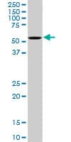 OXSR1 / OSR1 Antibody (clone 3A8)