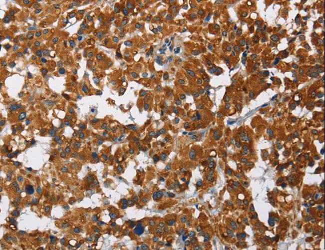 CAT / Catalase Antibody