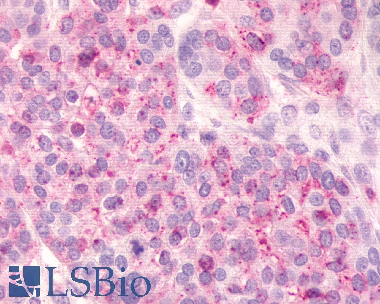 PathPlus™ Polyclonal Rabbit anti-Human FKSG80 / GPR81 Antibody (Extracellular Domain, IHC)