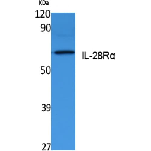CRF2-12 / IL28RA Antibody (Internal)