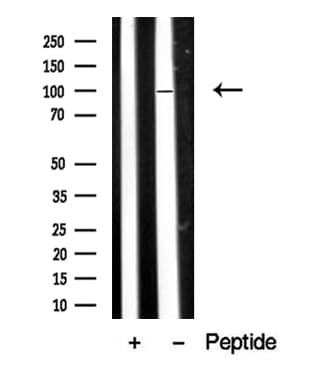 DAG1 / Dystroglycan Antibody