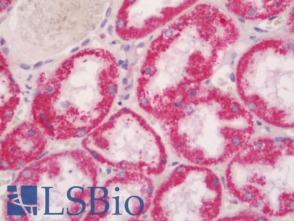 IHC-plus™ AMDHD1 Antibody (aa152-414)