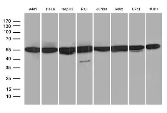 Monoclonal Mouse anti-Human HNRNPH1 / hnRNP H Antibody (clone OTI1H3, IHC, WB)