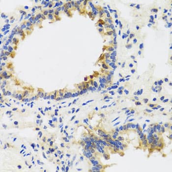 UVRAG Antibody