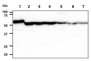 ADSL / Adenylosuccinate Lyase Antibody (clone AT16C10)