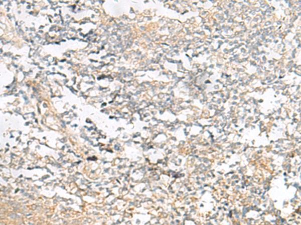 Polyclonal Rabbit anti-Human HELT Antibody (IHC)