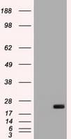 Monoclonal Mouse anti-Human IL6 / Interleukin 6 Antibody (clone OTI2C9, WB)