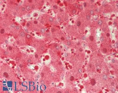 IHC-plus™ DBI / ACBD1 Antibody (aa2-105)