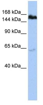 TNKS / Tankyrase Antibody (aa972-1021)