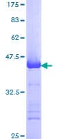 Human MCM3 Protein (Recombinant GST, N-terminus)