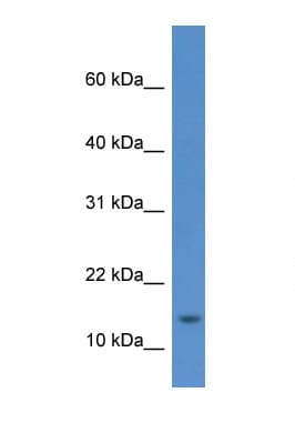 Polyclonal Rabbit anti-Human HIST1H2AE Antibody (aa60-109, WB)
