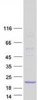 Human IFITM10 Protein (Recombinant Myc-DDK (Flag))