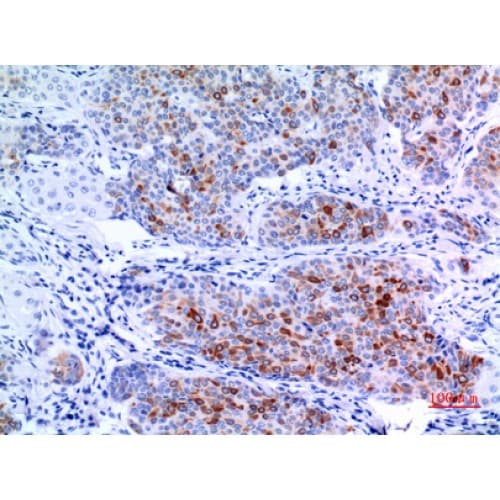 Polyclonal Rabbit anti-Human Pan Cytokeratin Antibody (IHC, WB)